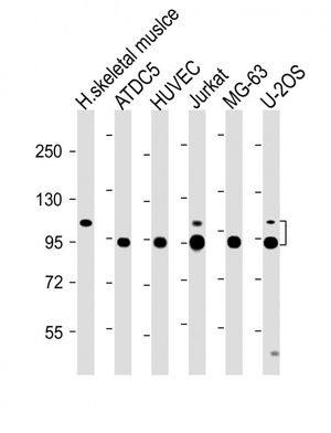 COMP antibody, Internal