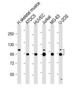 COMP antibody, Internal