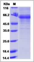 Human Adiponectin protein, human IgG1 Fc tag