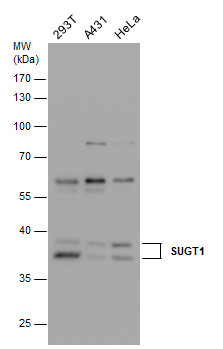 SUGT1 antibody [N1C3]