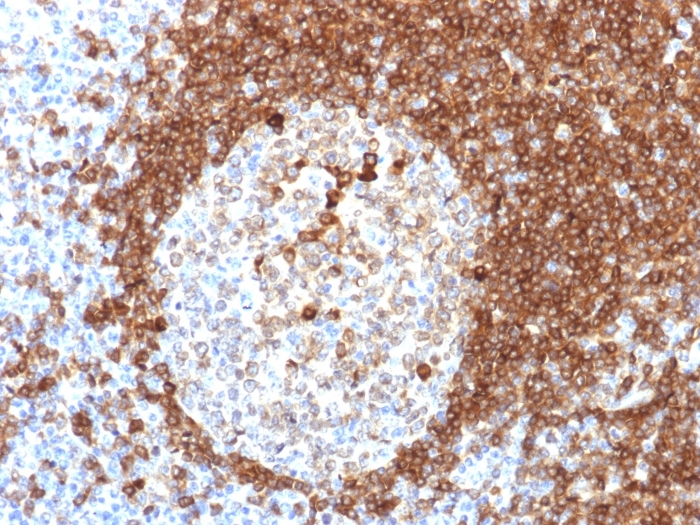 CD79a antibody [HM57]