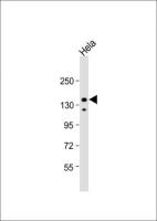 IRS2 antibody, C-term