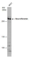 Neurofibromin antibody