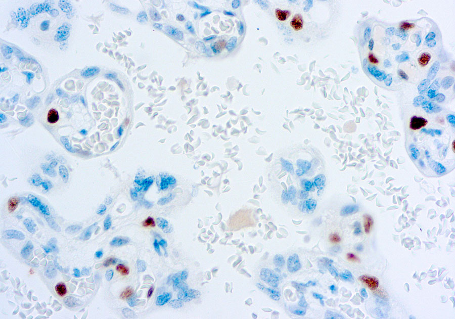 p57 Kip2 antibody [57P06]