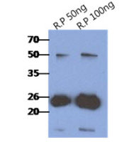 RAIDD antibody [AT14G8]