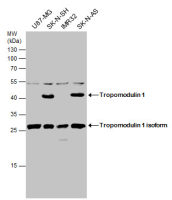 Tropomodulin 1 antibody