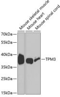 Tropomyosin 3 antibody