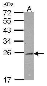 RAB2A antibody [N1C3]