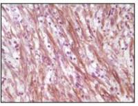 Desmin antibody [10H7D2]