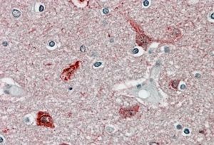 CaMKII alpha antibody, Internal