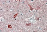 CaMKII alpha antibody, Internal