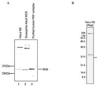 WDR61 antibody - ChIP grade