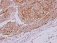 Lactate Dehydrogenase C antibody