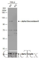alpha Glucosidase II antibody [C2C3], C-term