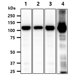Hexokinase I + Hexokinase II + Hexokinase III antibody [AT4C12]