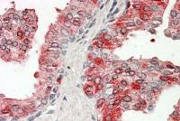 Prostatic Acid Phosphatase antibody, Internal