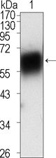 ROR1 antibody [2H6]