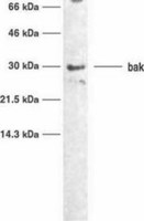 BAK antibody [TC100]