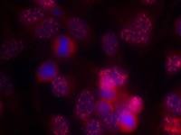 PKC delta antibody