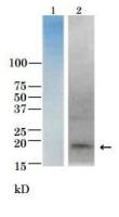 Vibrio parahaemolyticus TRH Toxin antibody