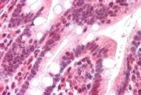 DNA polymerase lambda antibody, C-term