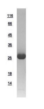 Human GSTM5 protein, His tag