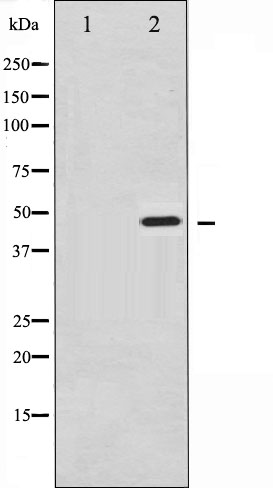 Synaptotagmin 1 (phospho Ser312) + Synaptotagmin 2 (phospho Ser309) antibody