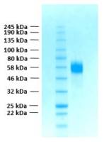 Human FGFR4 (extracellular region) protein, His tag