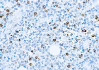 EBV antibody [CS1, CS2, CS3, CS4]