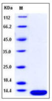 Human beta 2 Microglobulin protein, His tag