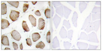 DUS2L antibody