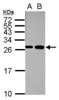 Fast skeletal myosin light chain 1 antibody