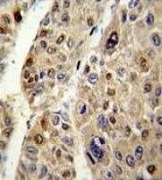 Antithrombin III antibody, C-term