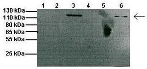 CLCN1 antibody, C-term