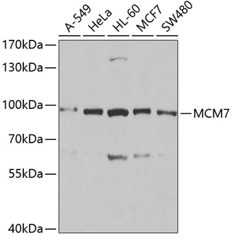 MCM7 antibody