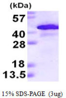 Human Alcohol dehydrogenase 1A protein, His tag