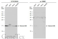 Histone H2B antibody
