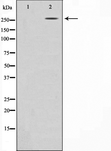 Acetyl-CoA Carboxylase 1 antibody