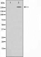 Acetyl-CoA Carboxylase 1 antibody