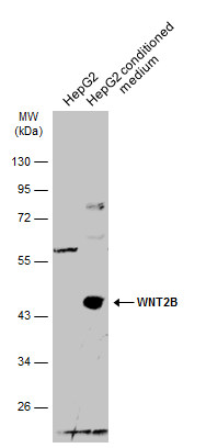 Wnt2b antibody