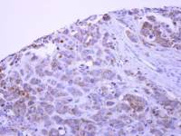 PACSIN1 antibody