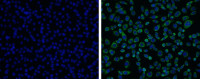 Japanese encephalitis virus NS3 antibody