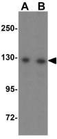 AP3B2 antibody