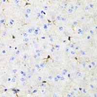 Activin Receptor Type IIA antibody
