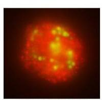 ACSL1 antibody, N-term