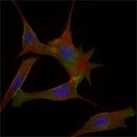 FABP2 antibody [9A9B7B3]