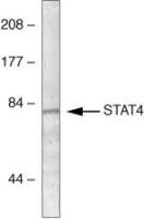 STAT4 antibody