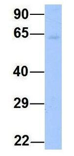 YTHDF3 antibody, N-term