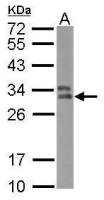 HLA-DPB1 antibody