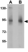 ZBTB5 antibody